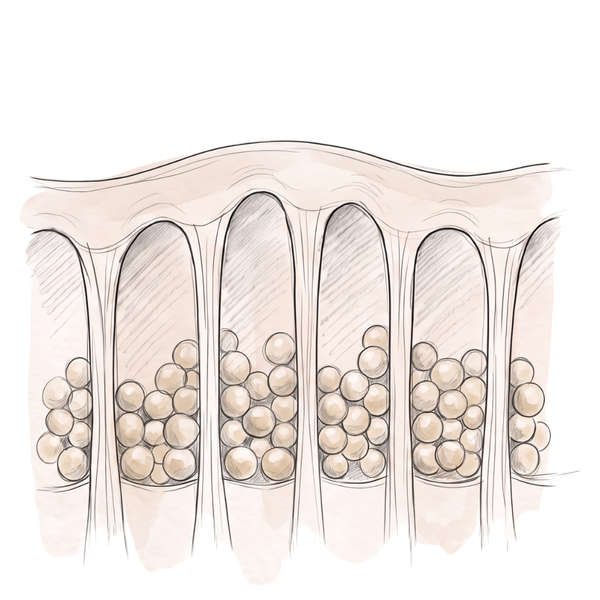 Skin dimples form where the bands pull.