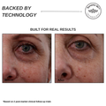 Sensilift Smart RF Skin-Firming