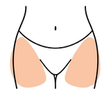 Caderas